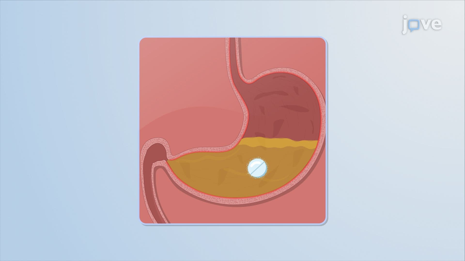 Modified-Release Drug Delivery Systems: Rate-Programmed I