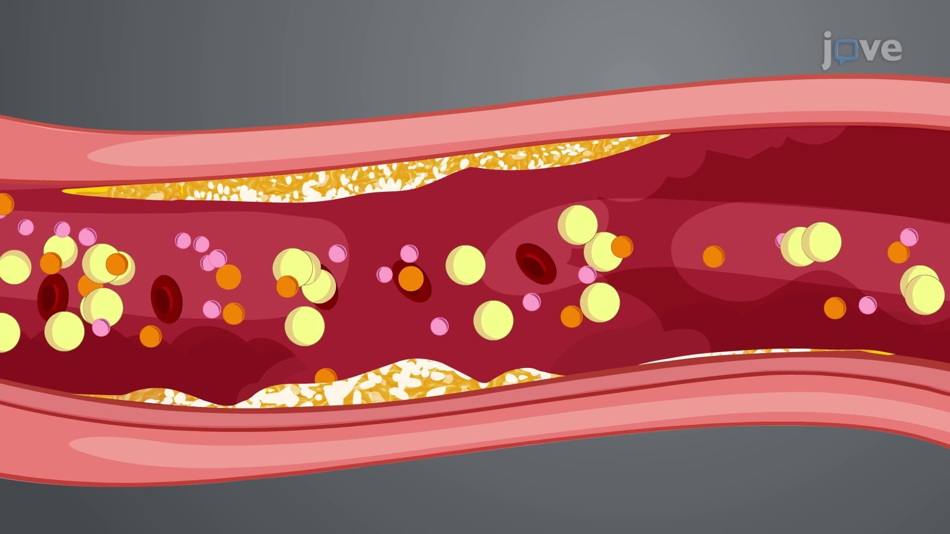 Imaging Studies for Cardiovascular System VI: Calcium -Scoring CT