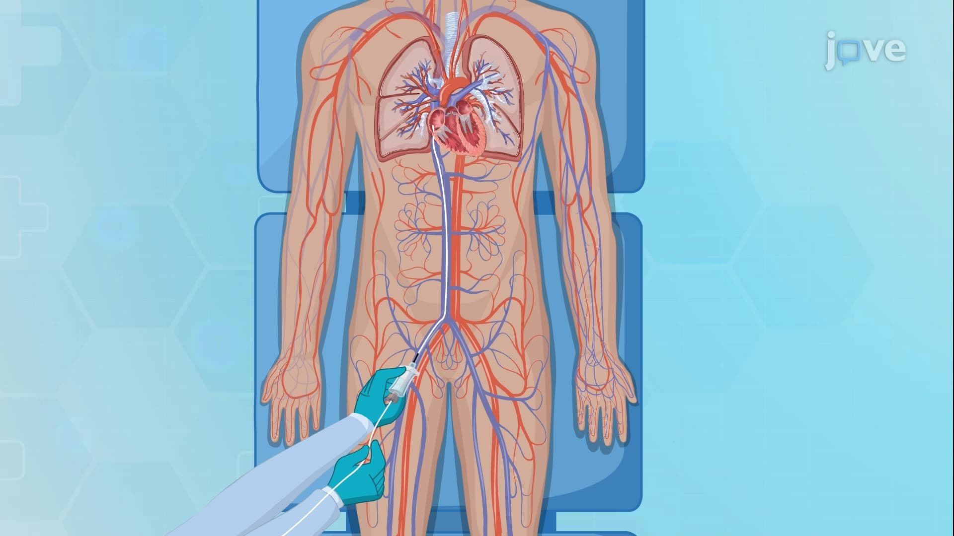Cardiac Catheterization I: Pre-Procedure Overview