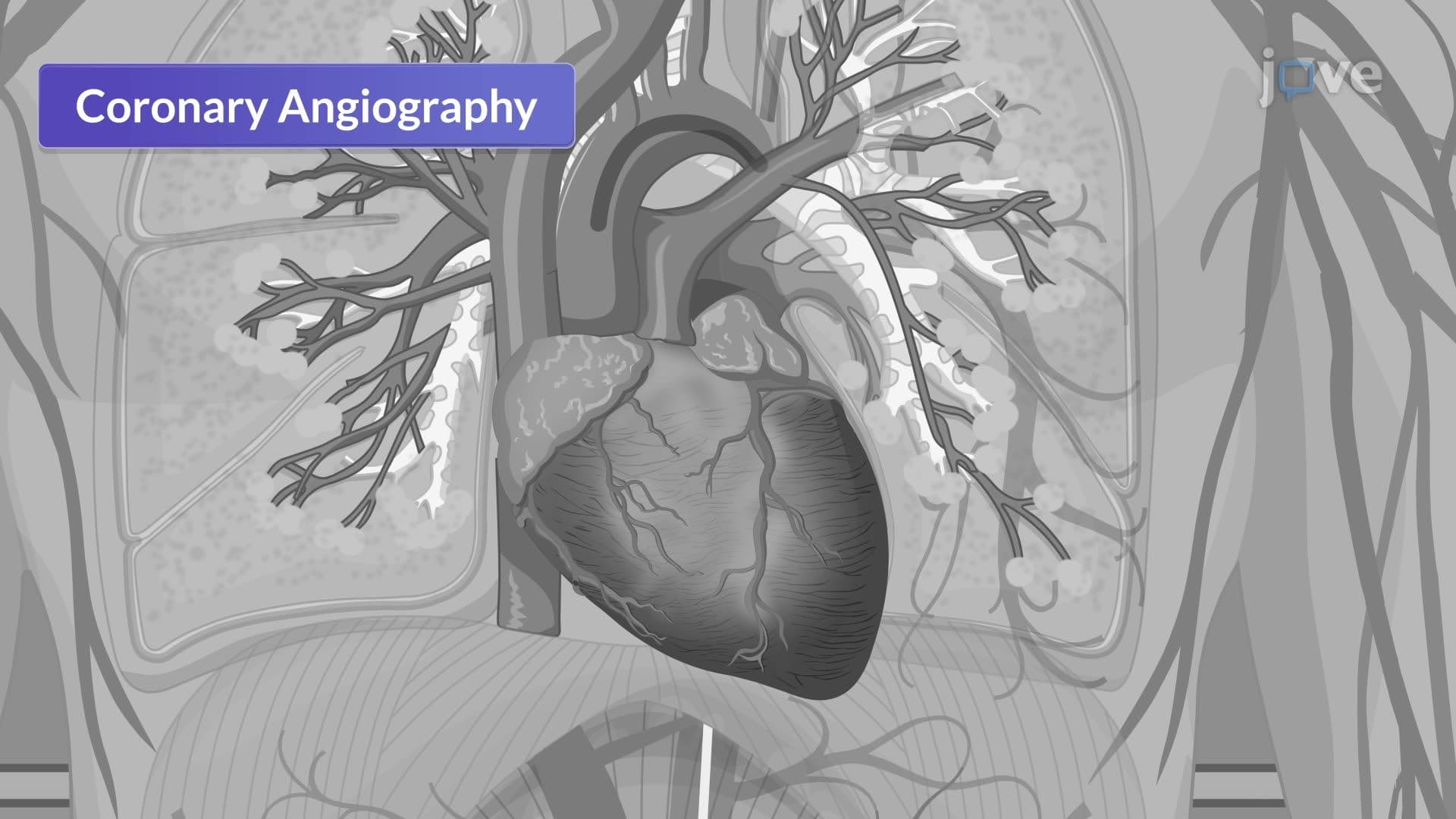 Cardiac Catheterization III: Left Heart Catheterization