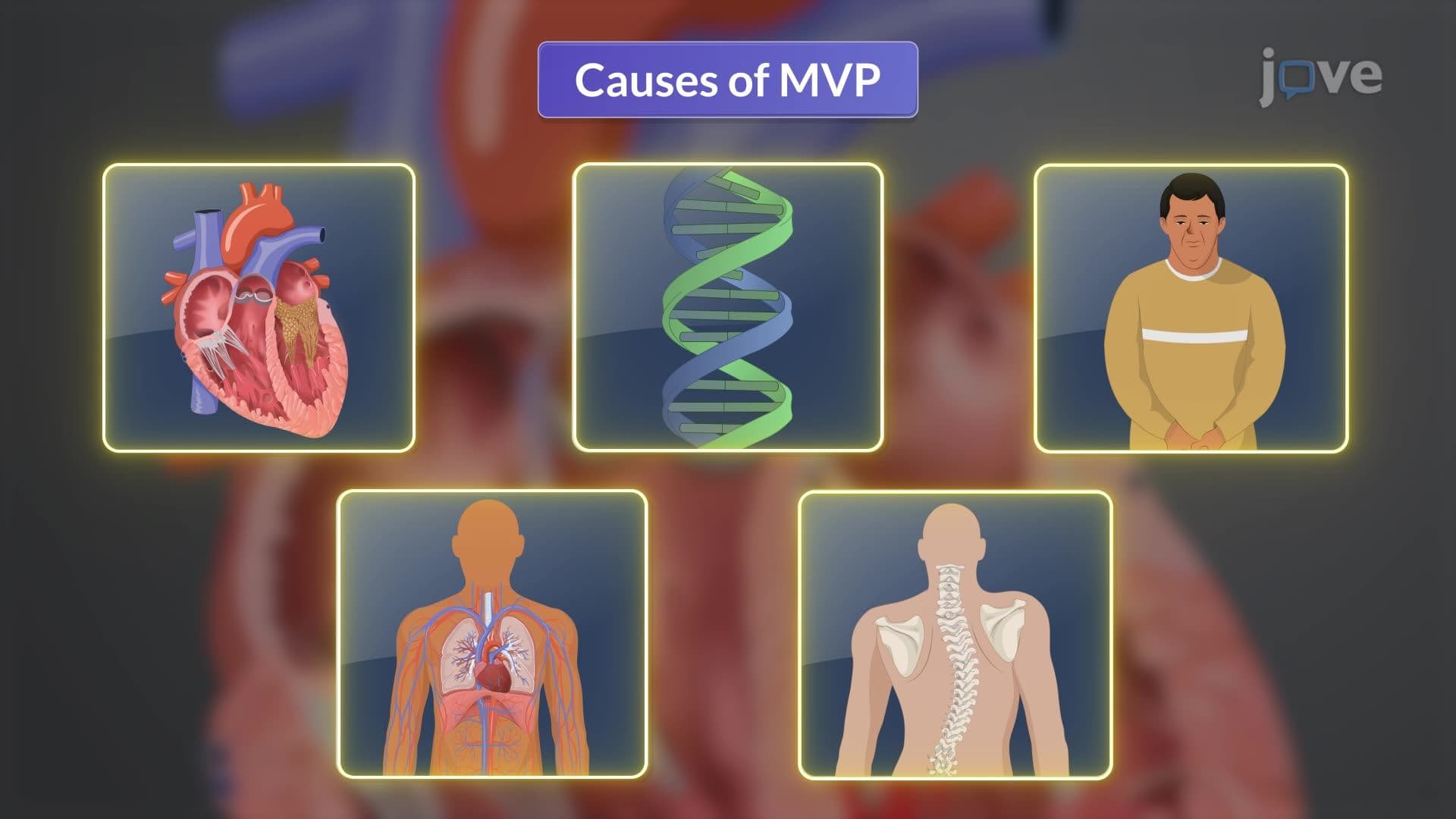 Mitral Valve Prolapse I: Introduction
