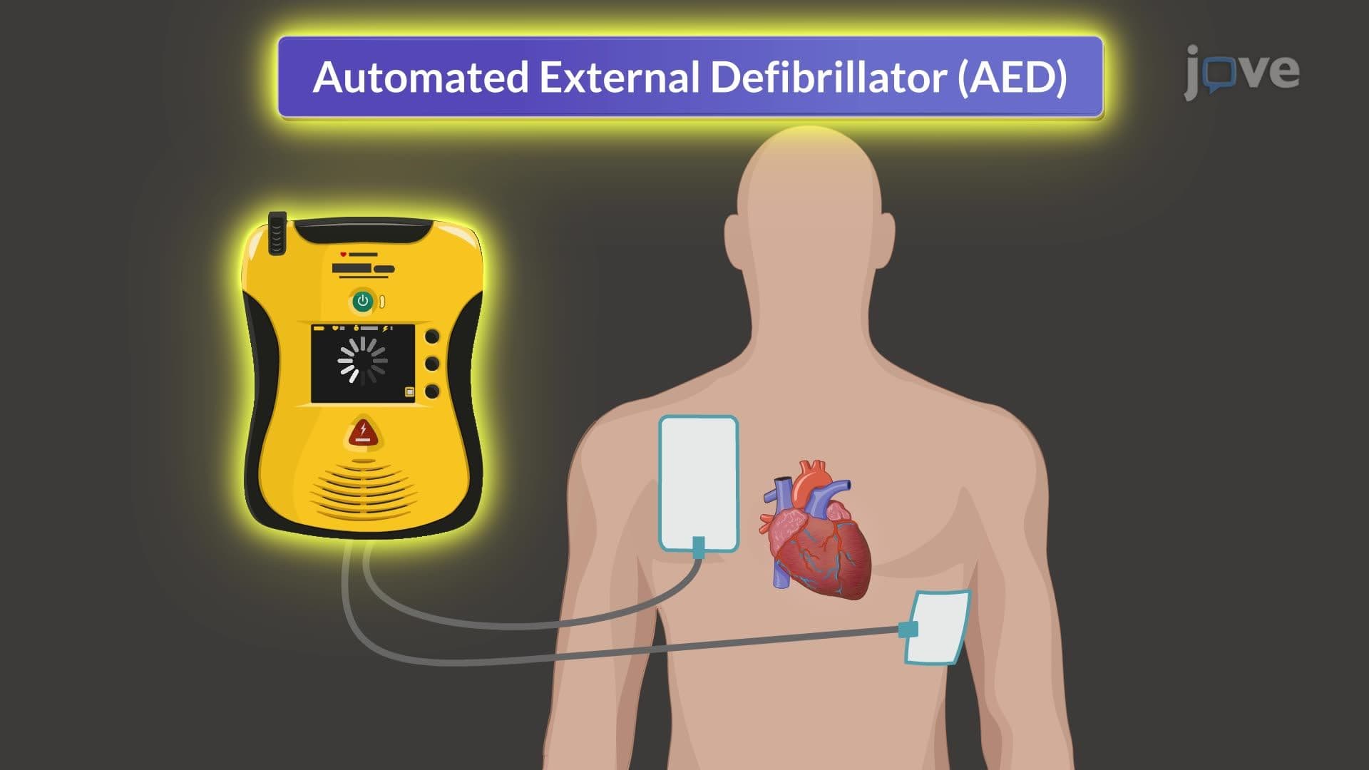 Cardiopulmonary Resuscitation III: AED Use