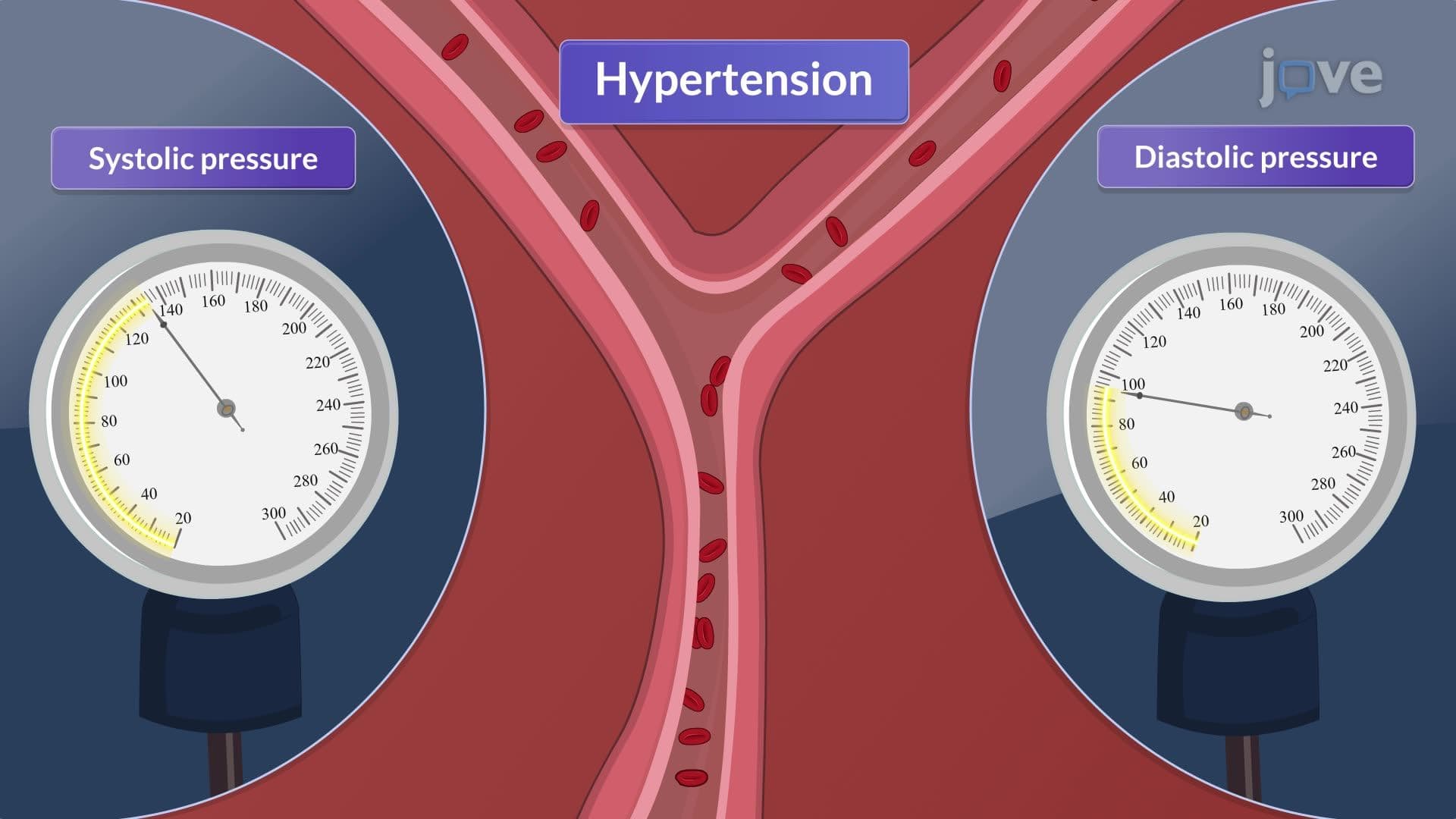Hypertension I: Introduction
