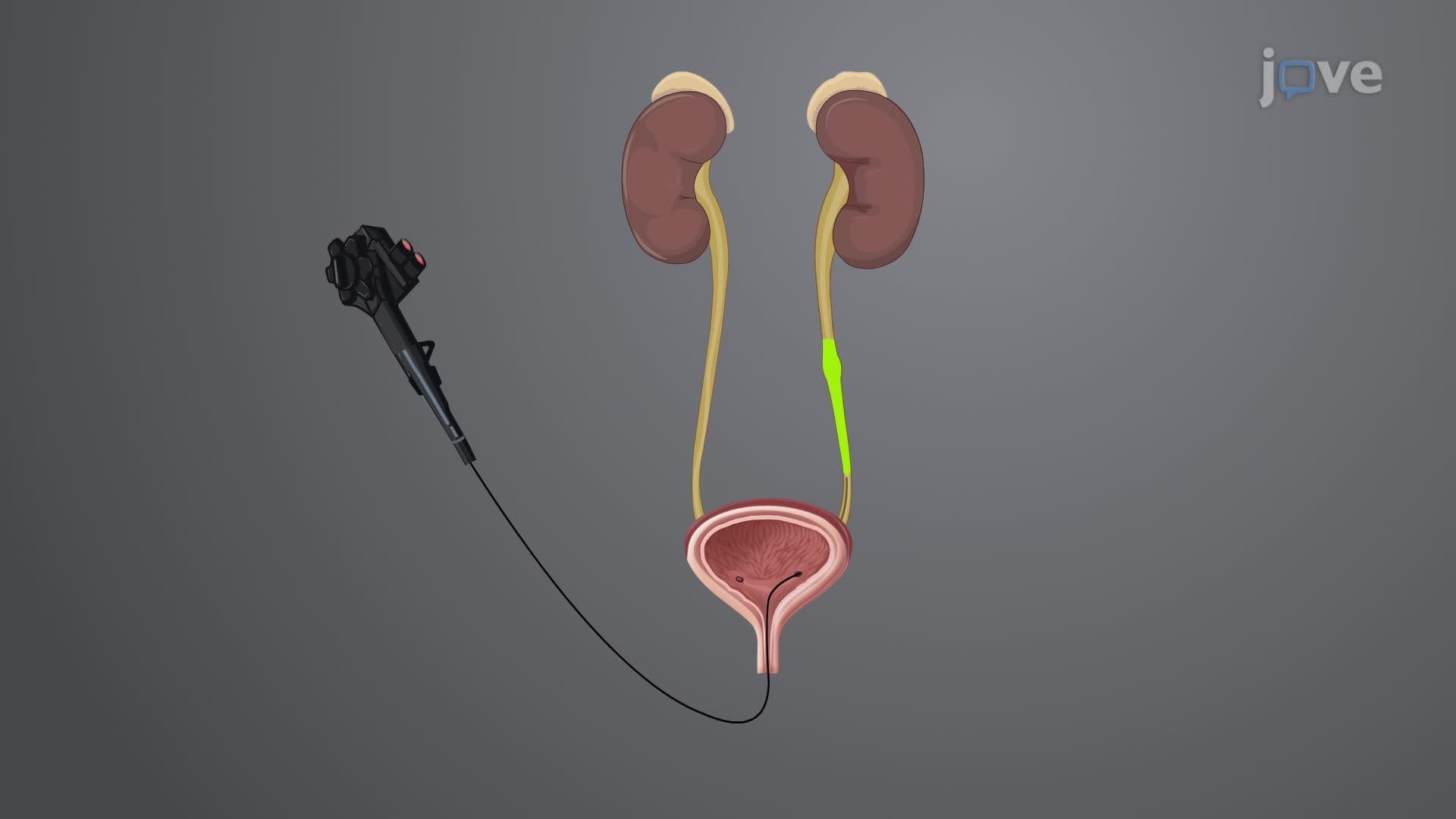 Imaging Studies V: Intravenous Urography and Retrograde Pyelography