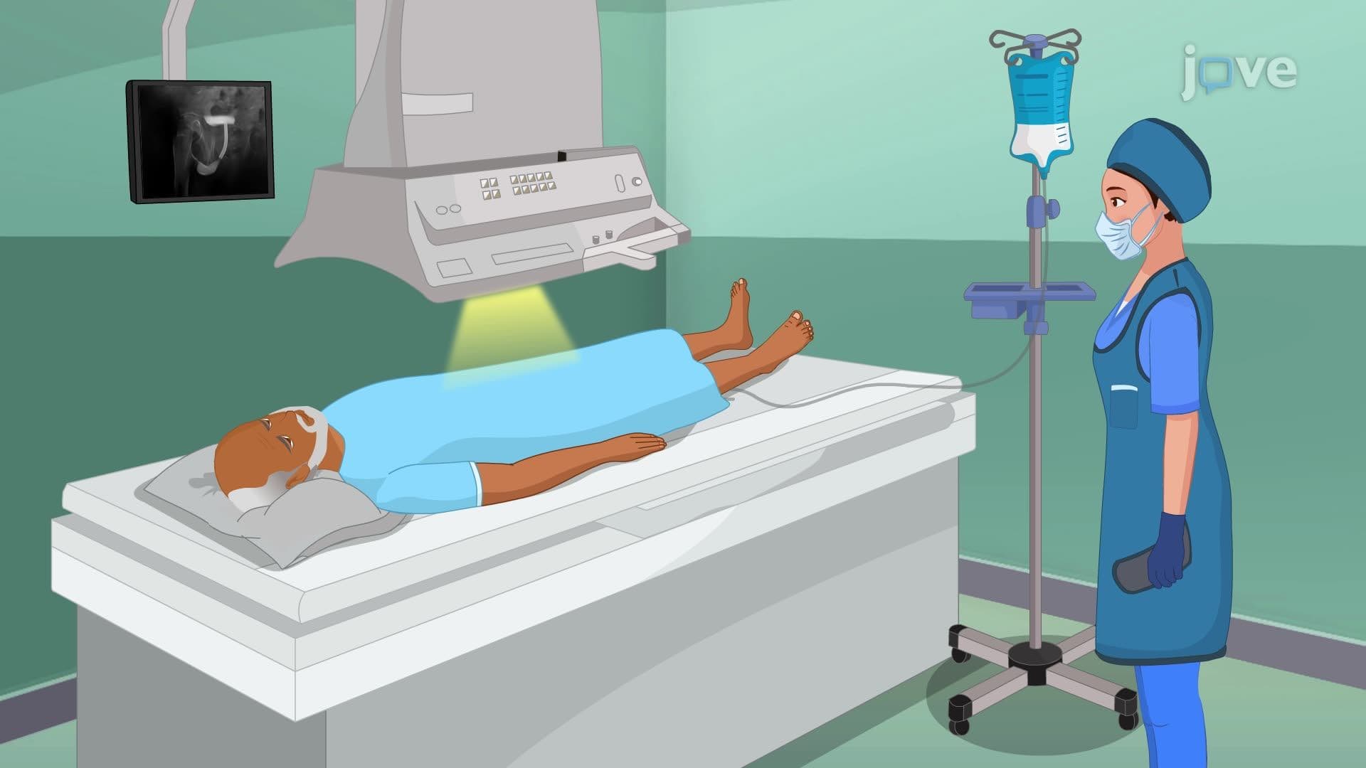 Imaging Studies VI: Voiding Cystourethrography and Cystography