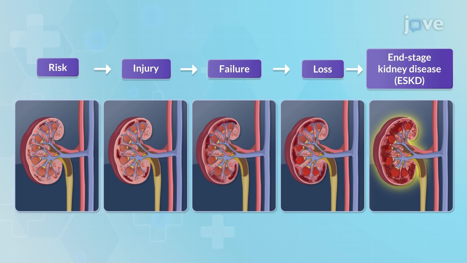 Acute Kidney Injury I: Introduction
