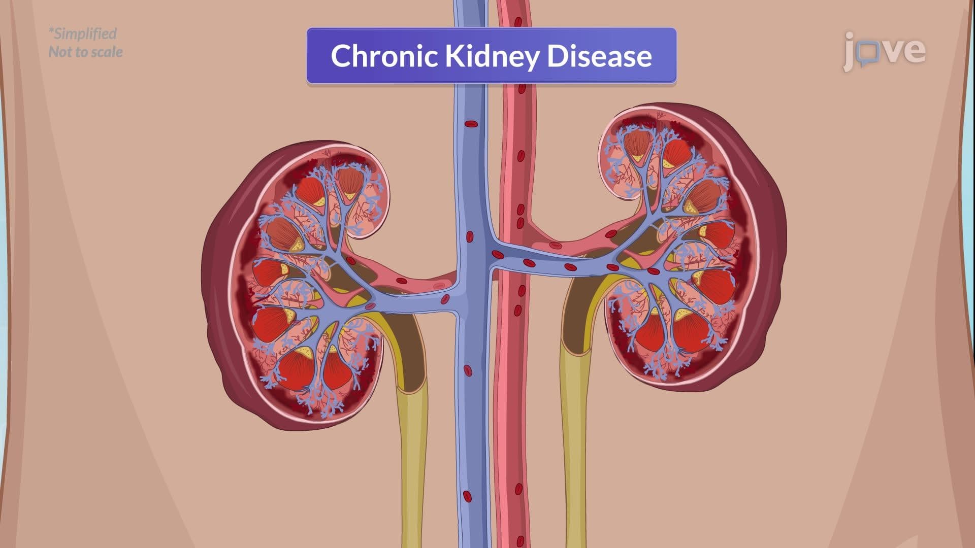 Chronic Kidney Disease II: Clinical Manifestations