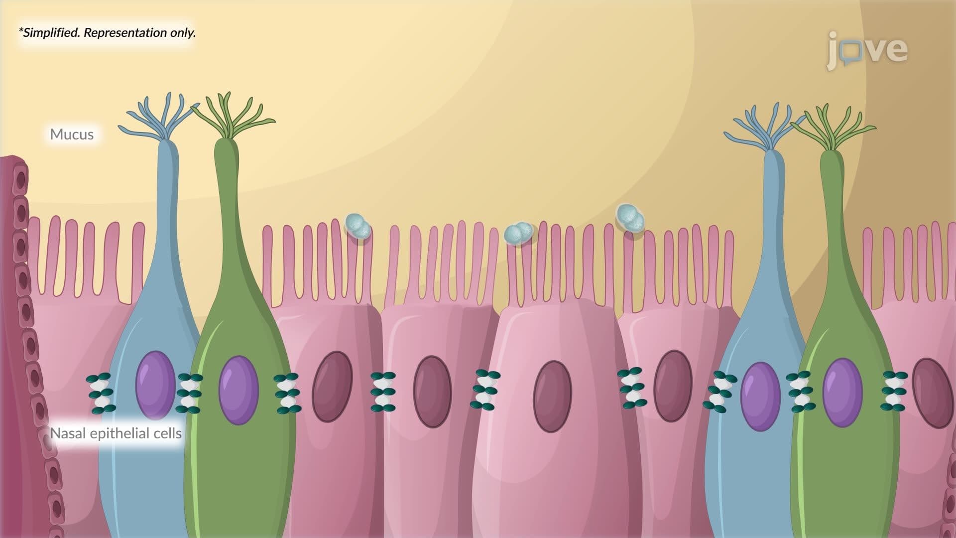 Bacterial Meningitis