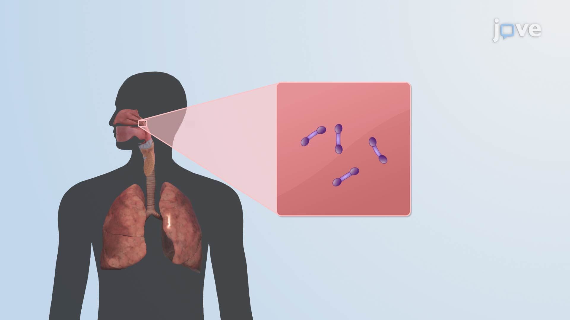 Diphtheria