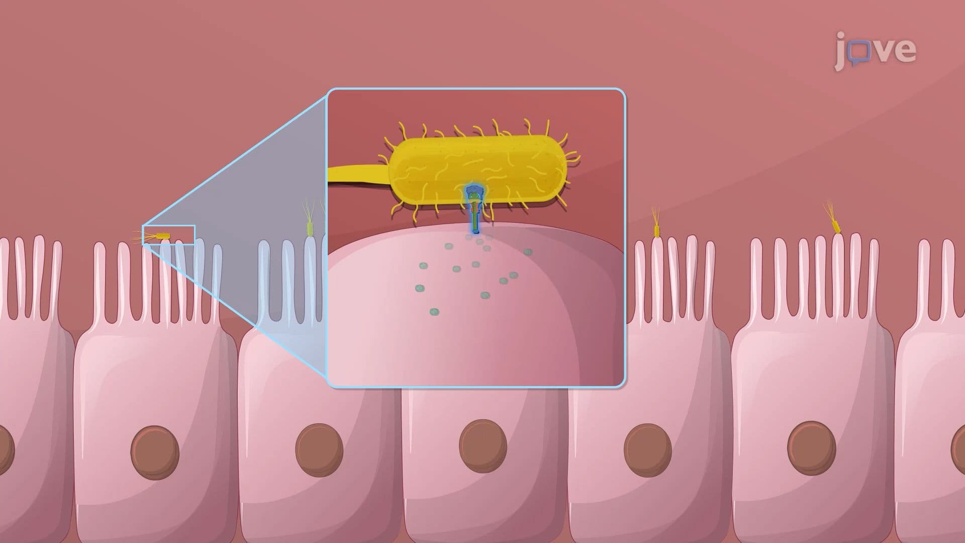 Bacterial Gastroenteritis
