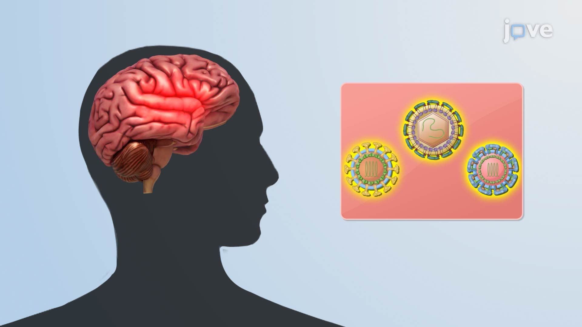 Arboviral Encephalitis