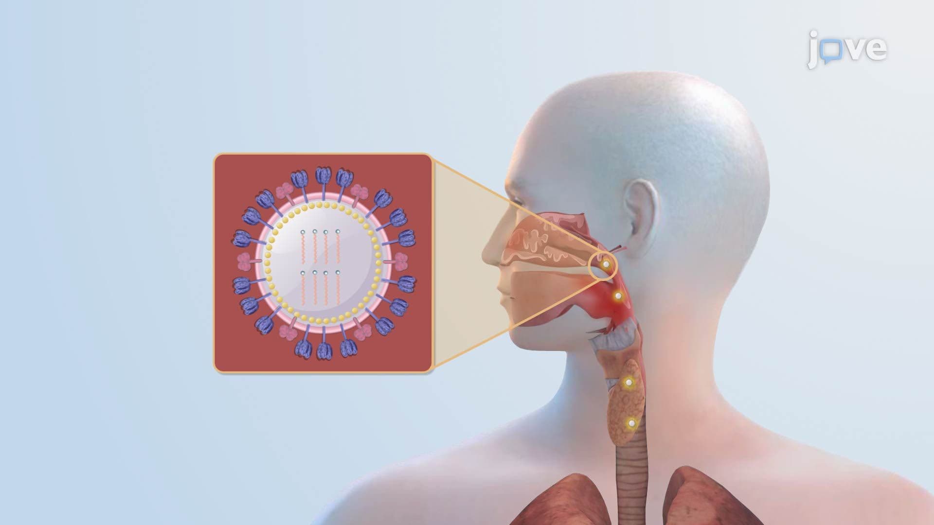 Influenza