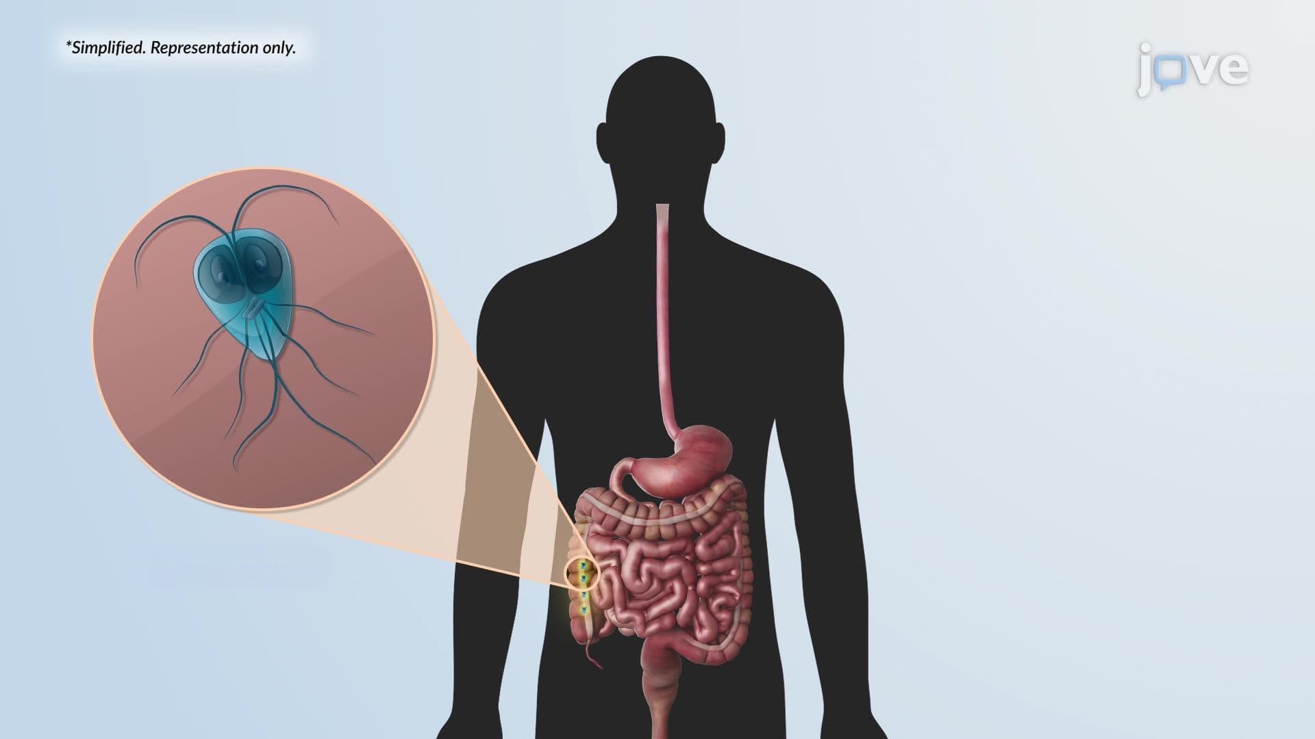 Giardiasis