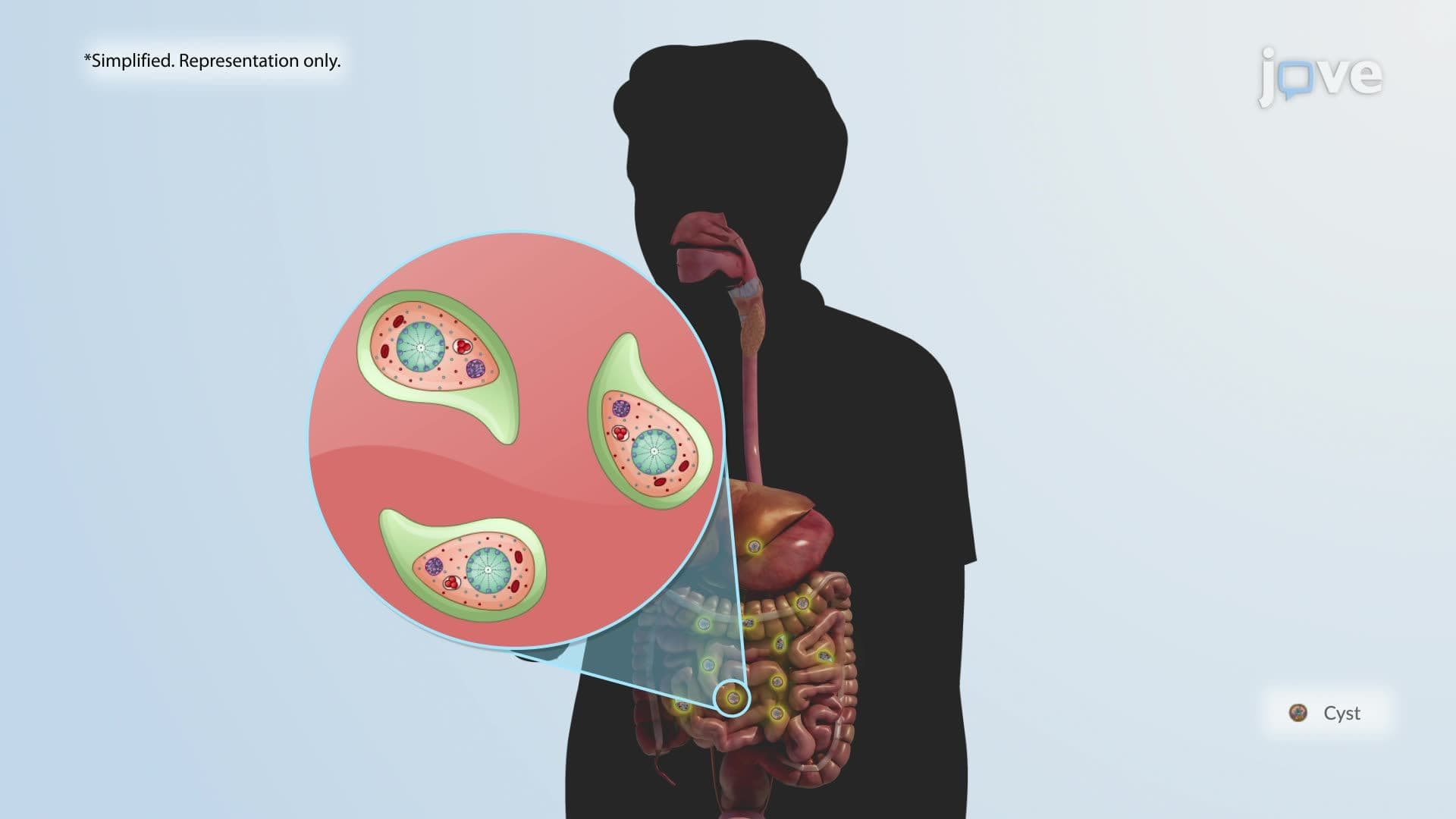 Amebiasis