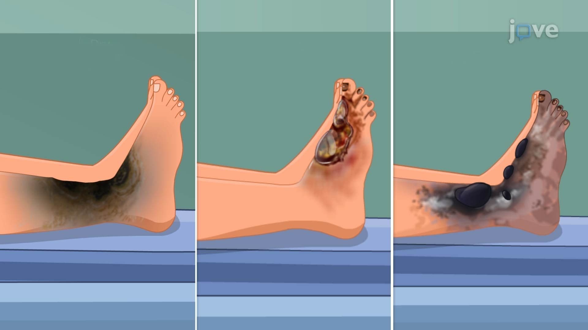 Cellular Injury IV: Necrosis