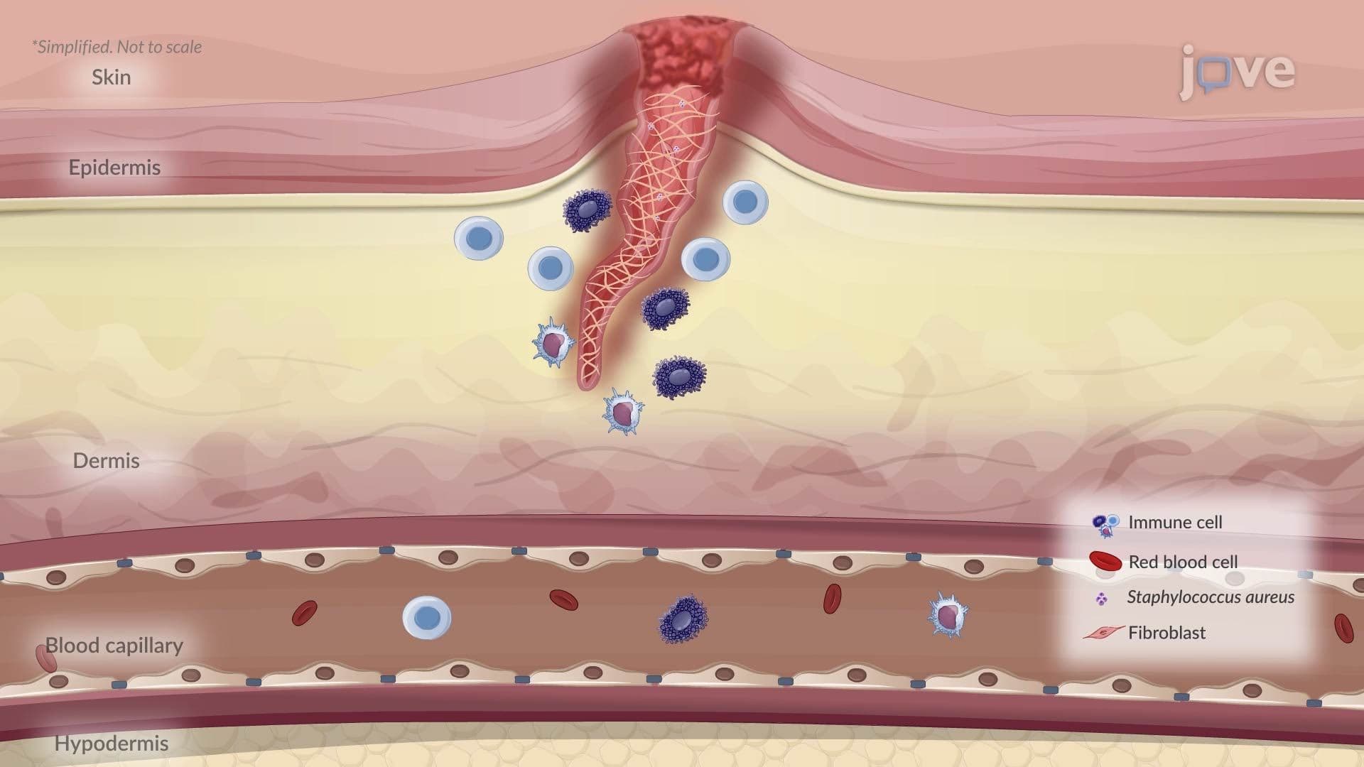 Chronic Inflammation: Introduction