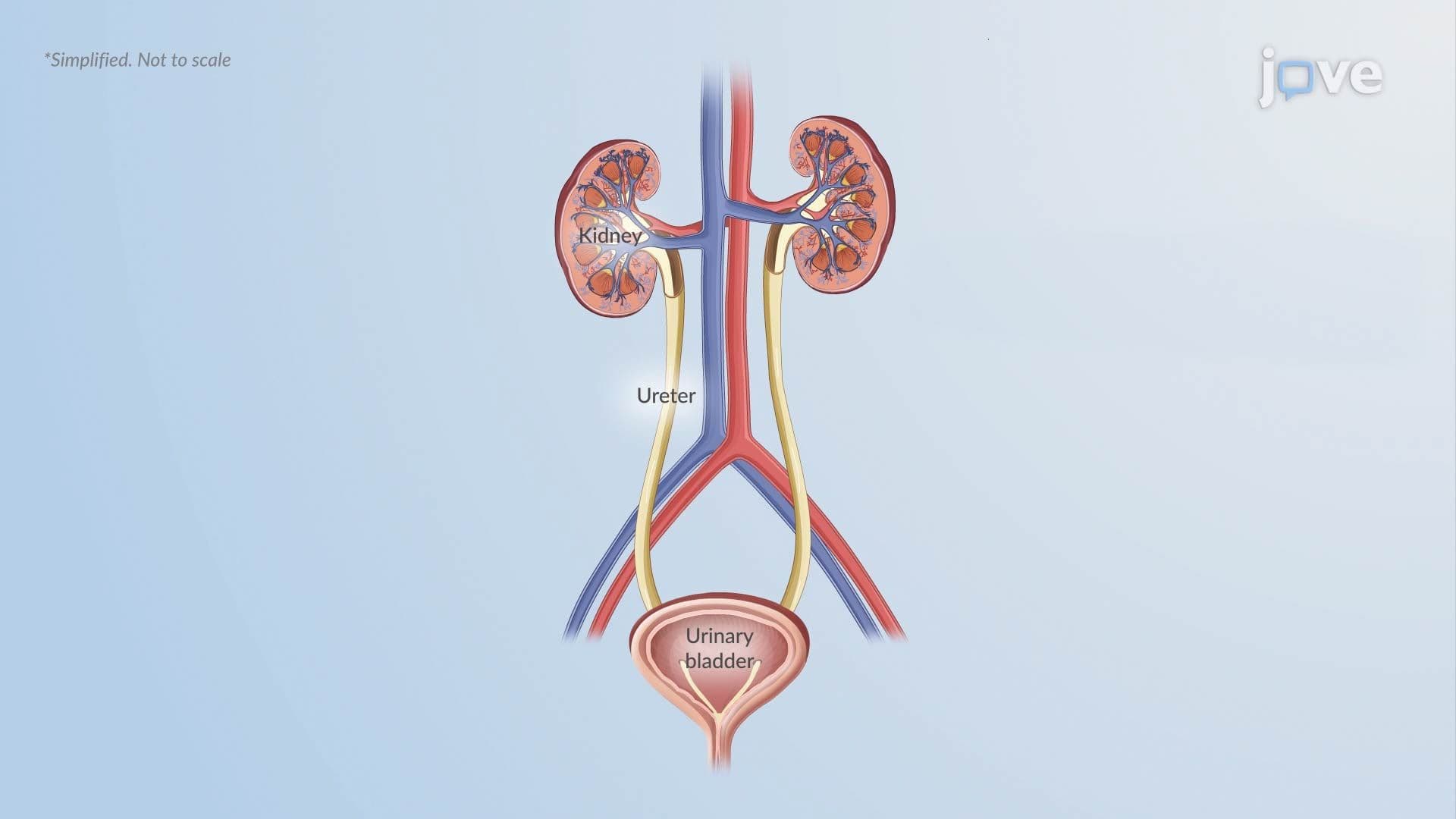 Diabetes Insipidus II: Pathophysiology