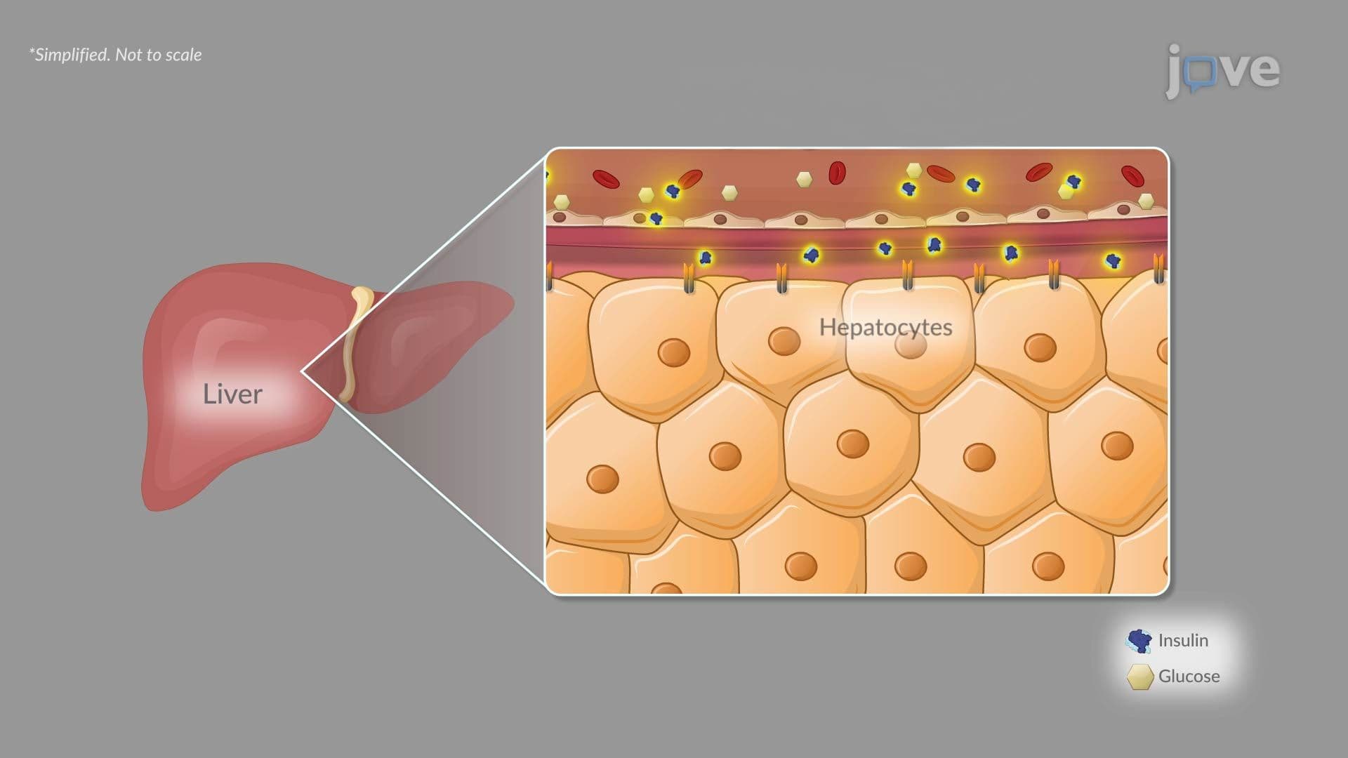 Type II Diabetes II: Pathophysiology