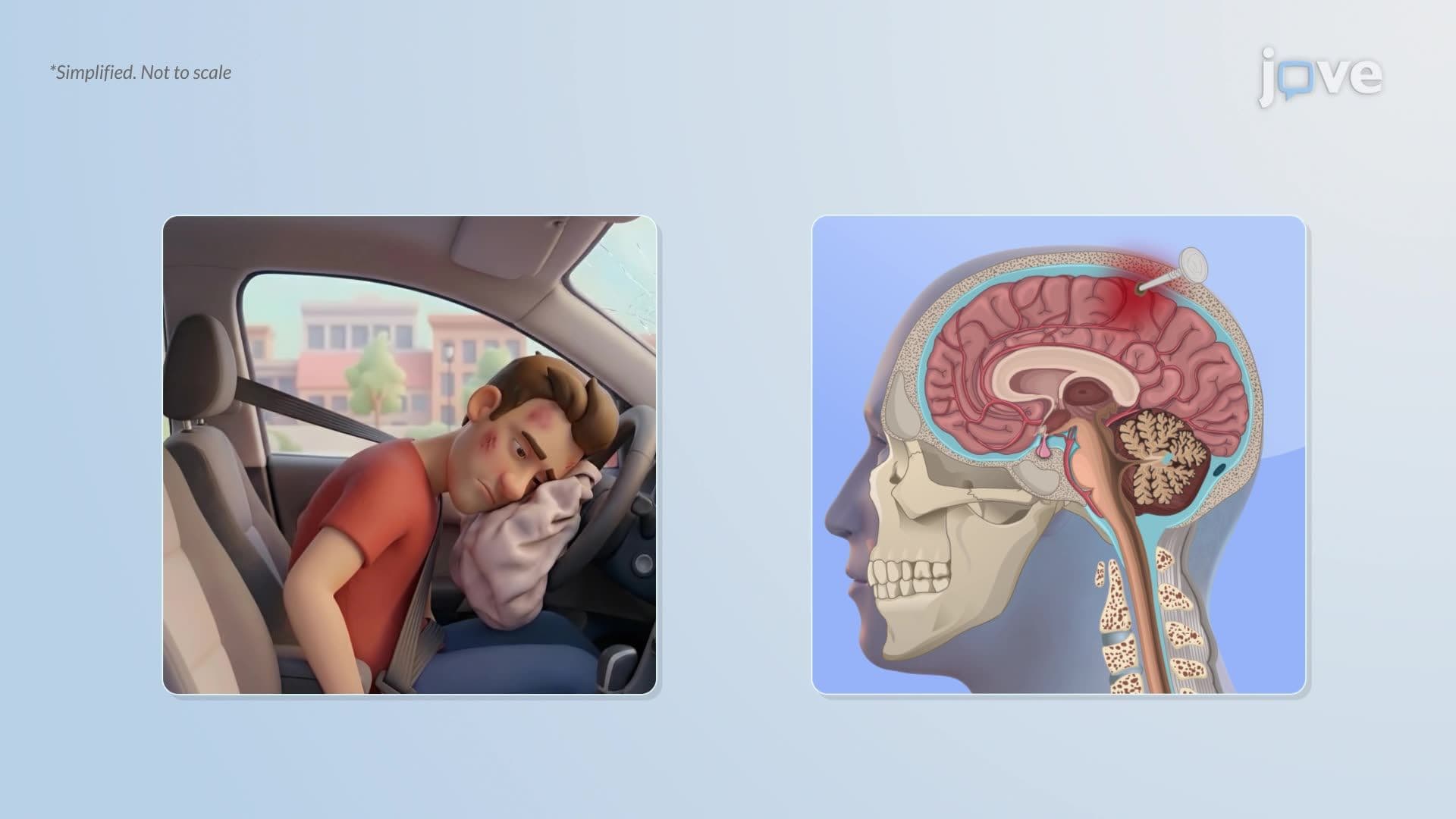 Traumatic Brain Injury l: Introduction