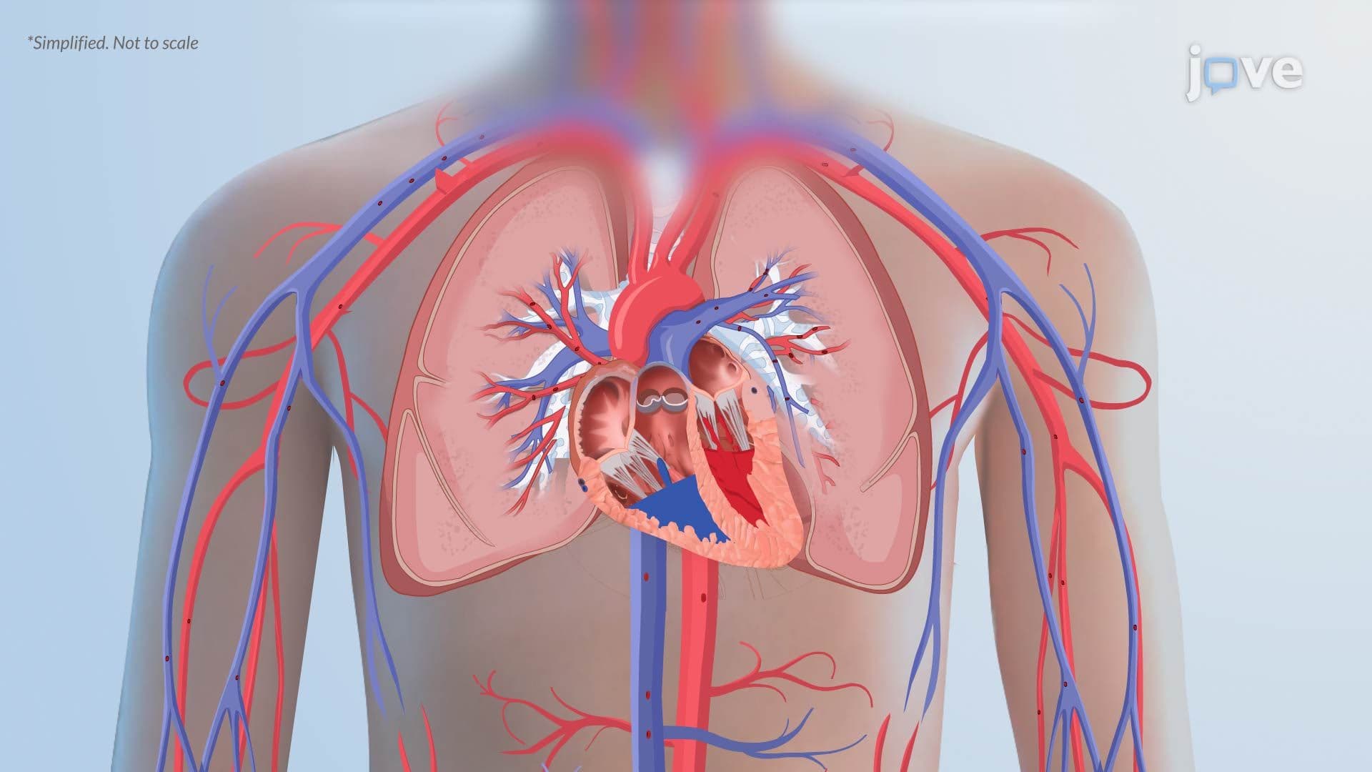 Pulmonary Edema II: Pathophysiology