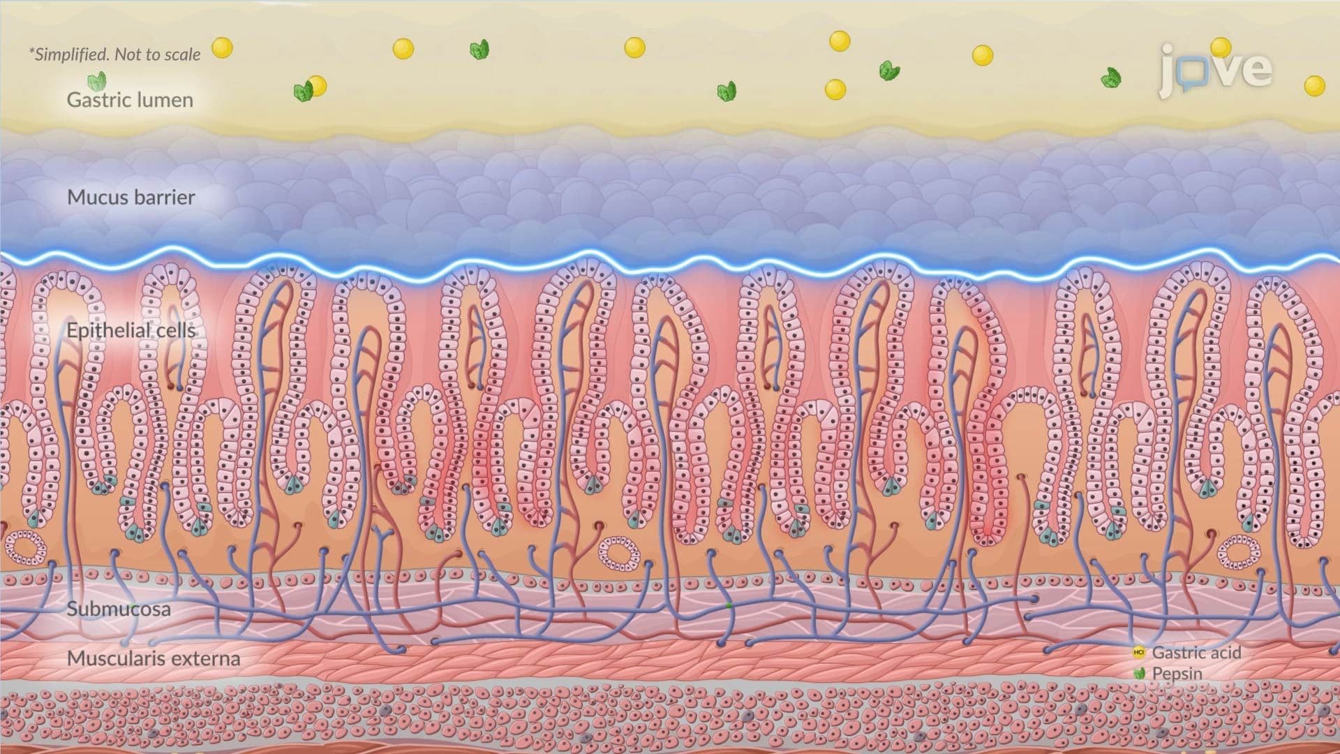 Peptic Ulcer Disease I: Introduction