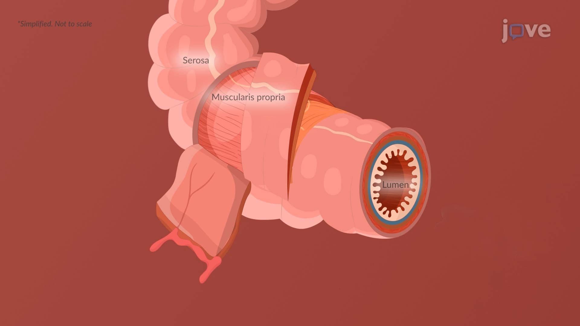 Inflammatory Bowel Disease IV: Clinical Manifestations