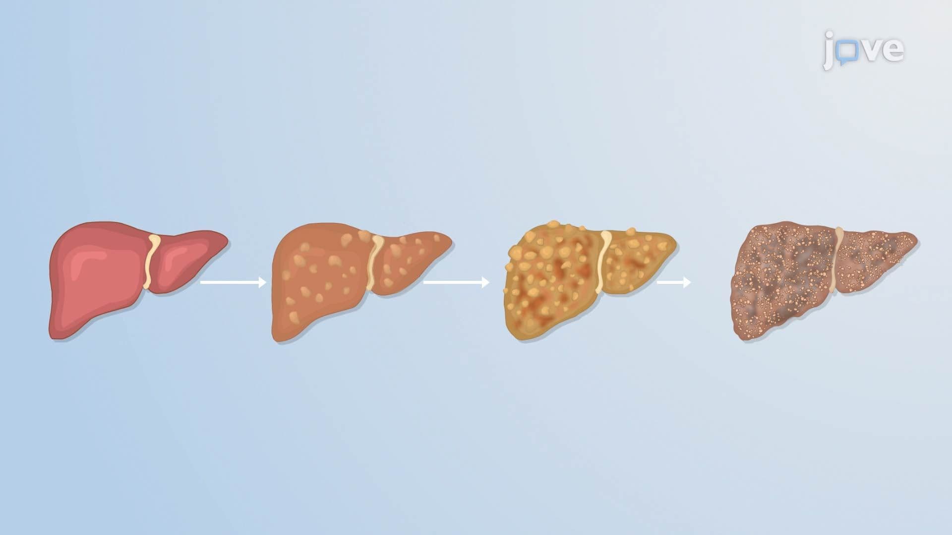 Cirrhosis I: Introduction