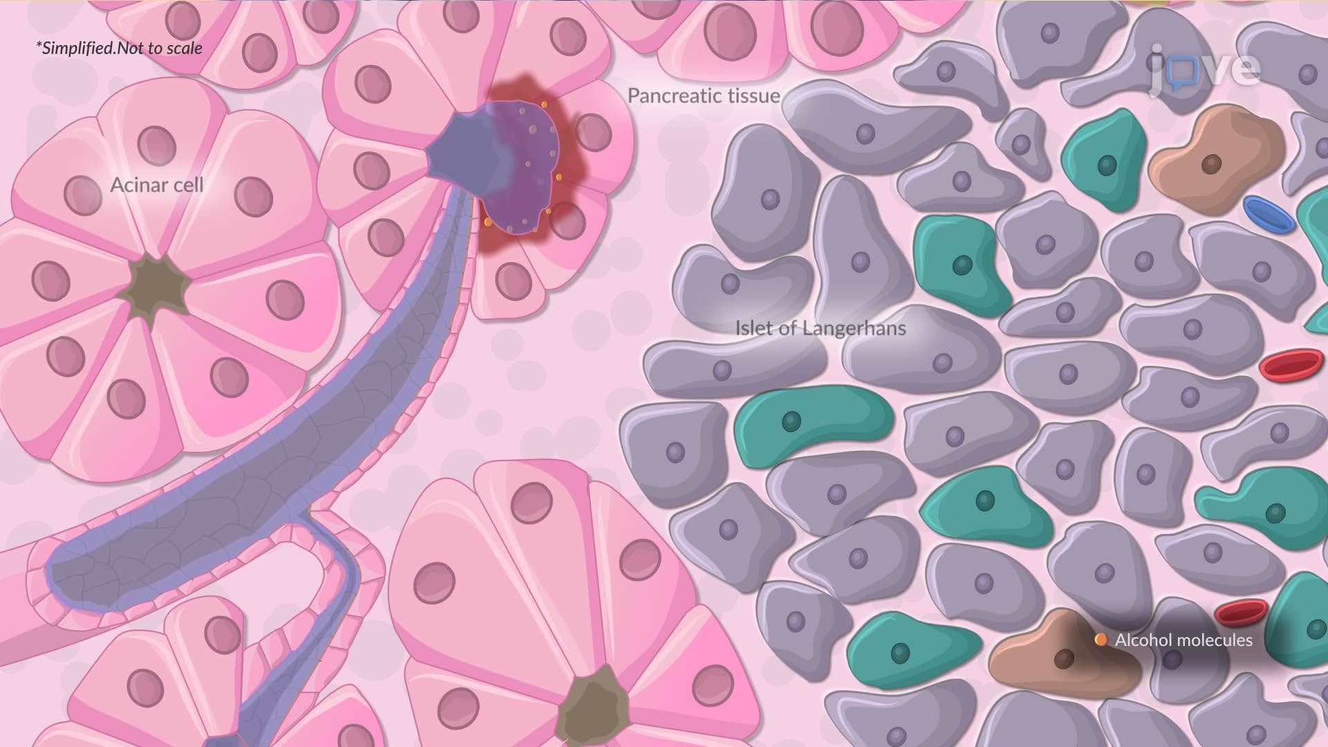 Acute Pancreatitis I: Introduction