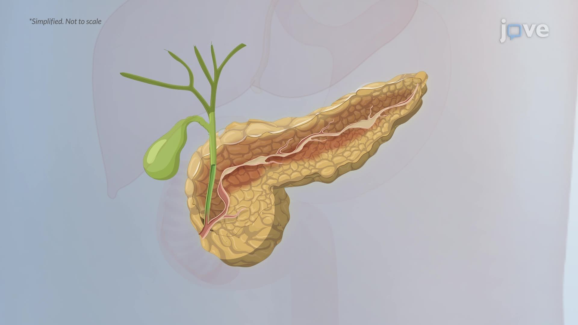 Chronic Pancreatitis II: Pathophysiology