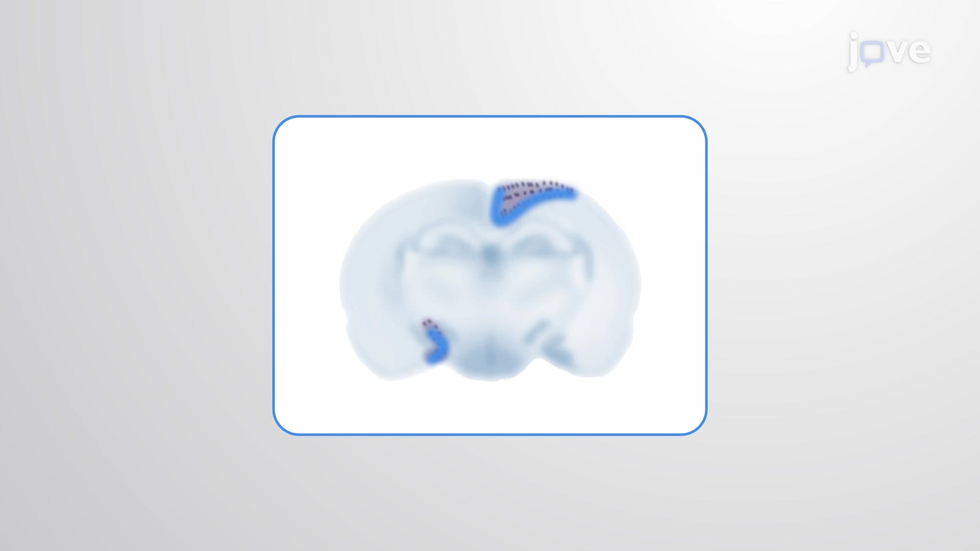In-situ Hybridization