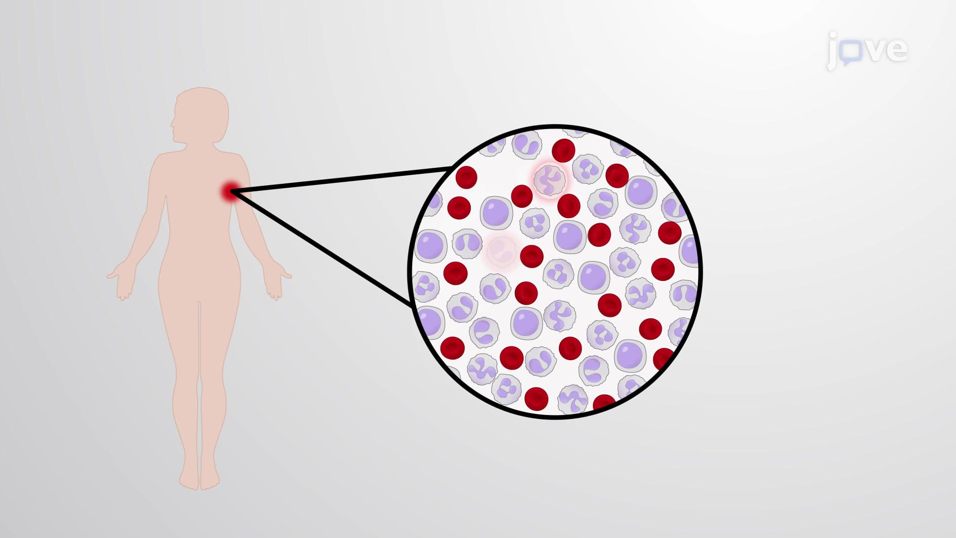 What is Cancer?