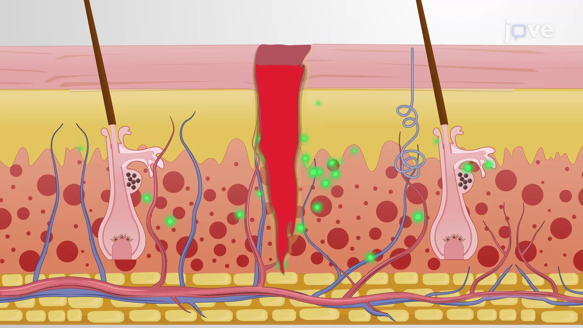Tissue Injury: Inflammation and Repair