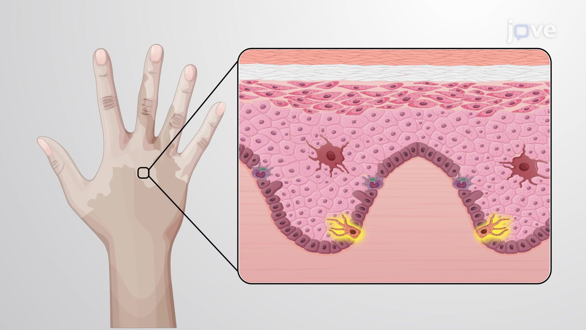 Skin Diseases and Disorders