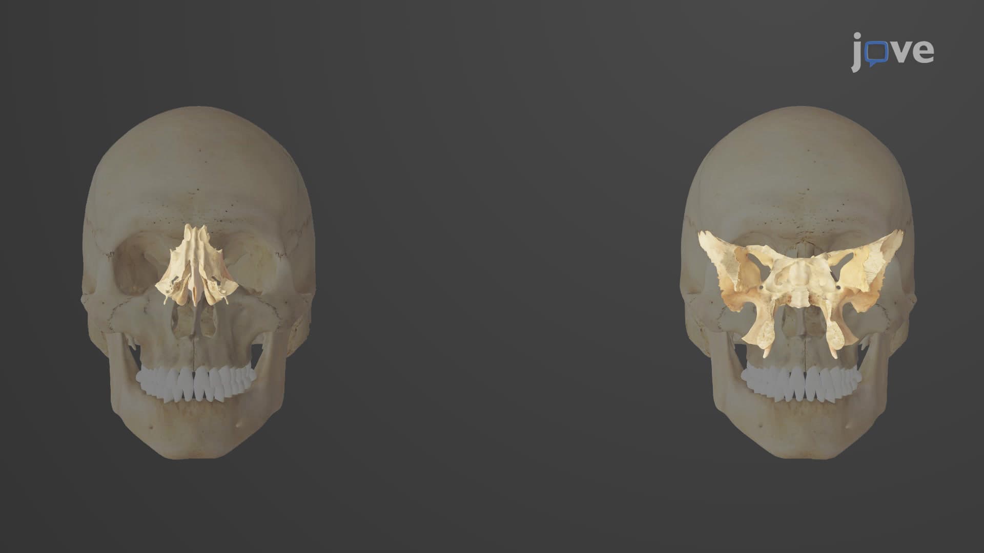 Overview of the Skull