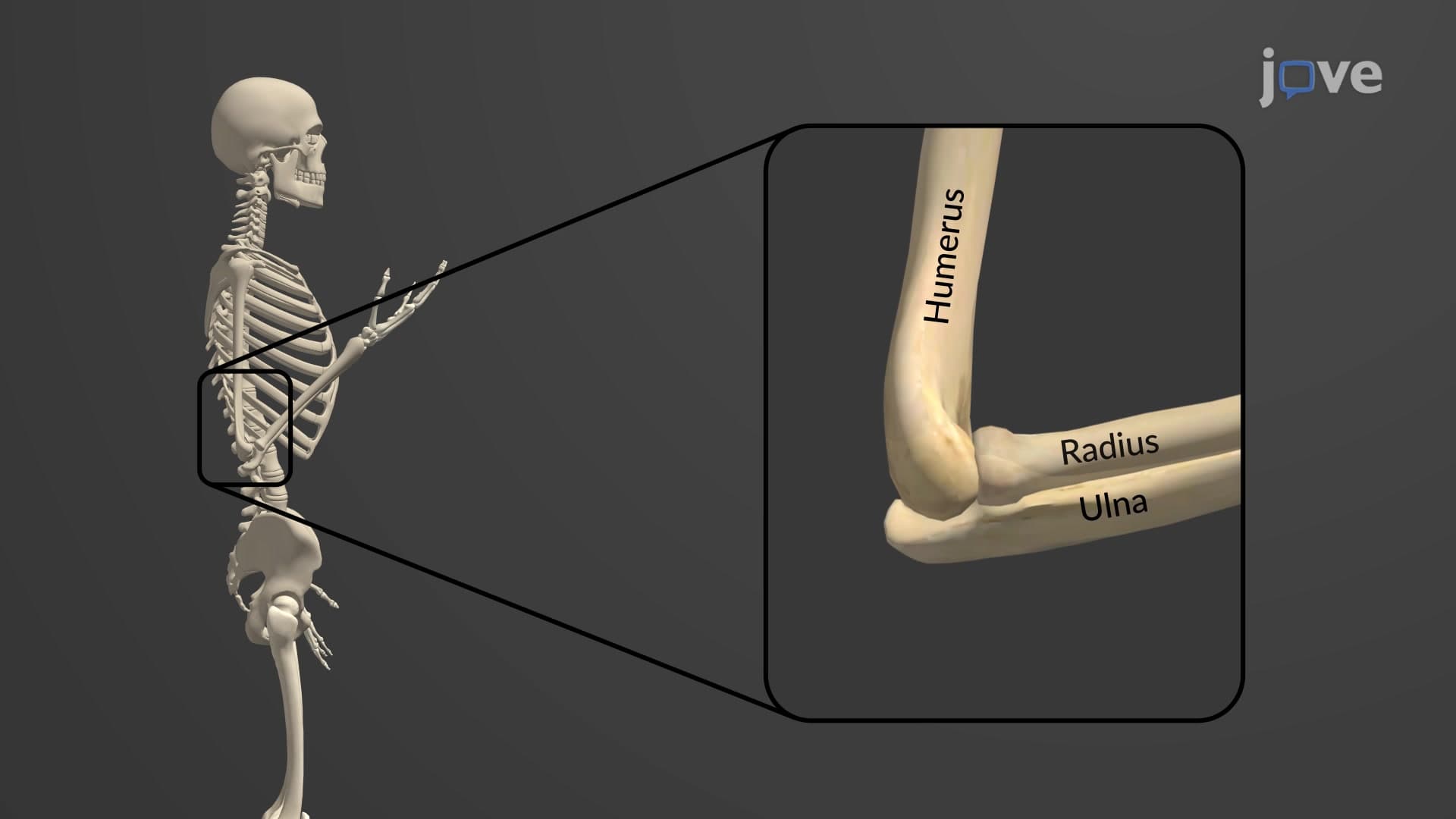 Bones of the Upper Limb: Ulna