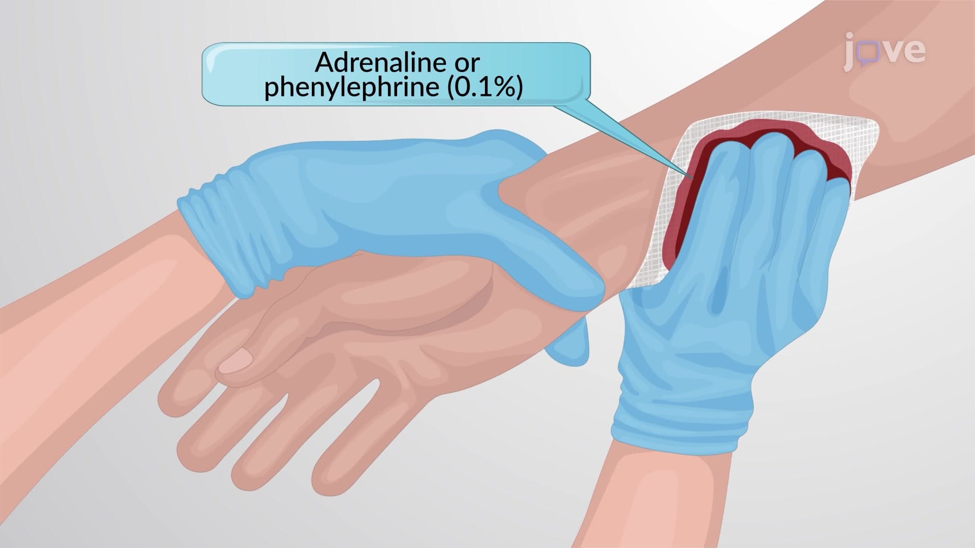 Adrenergic Agonists: Therapeutic Uses