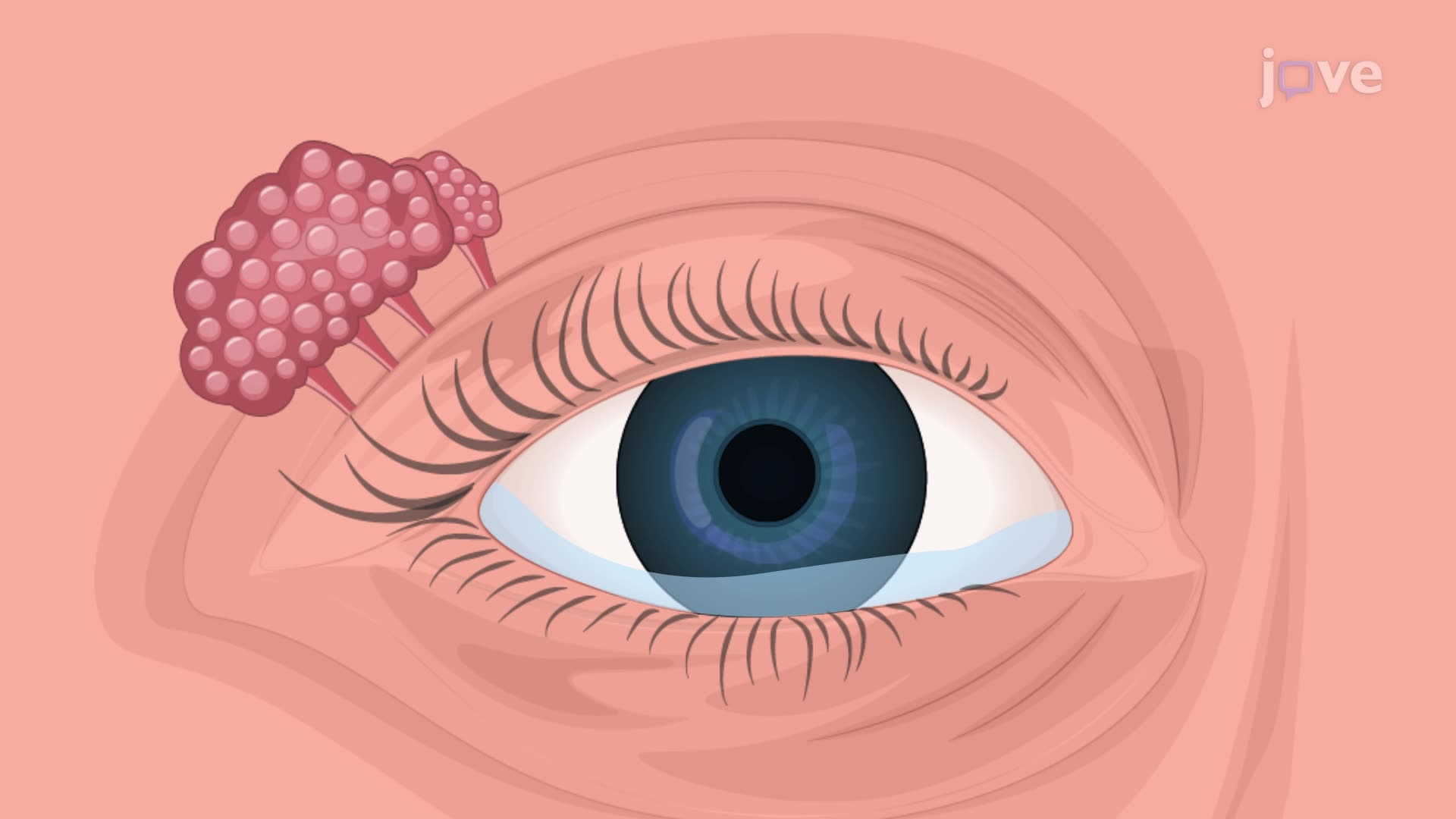 Accessory Structures of the Eye