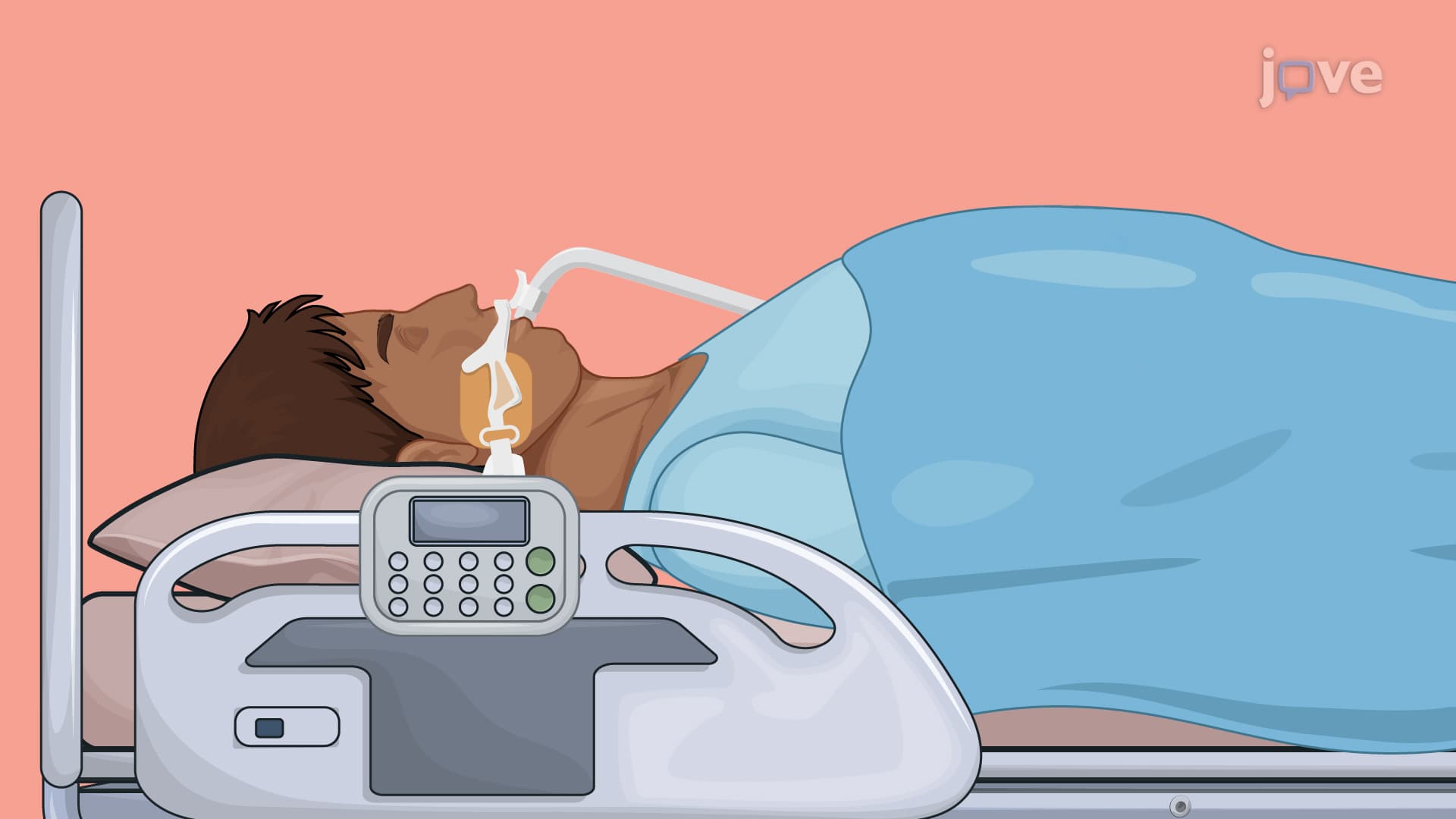 Inhalational Anesthetics: Overview