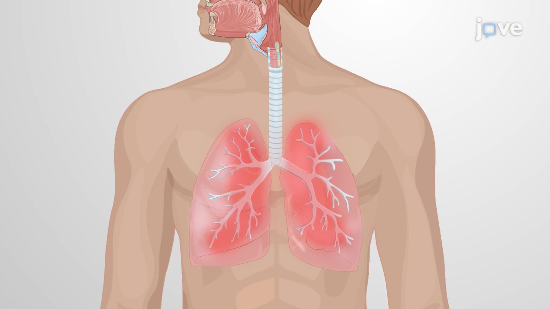 Common Respiratory Disorders