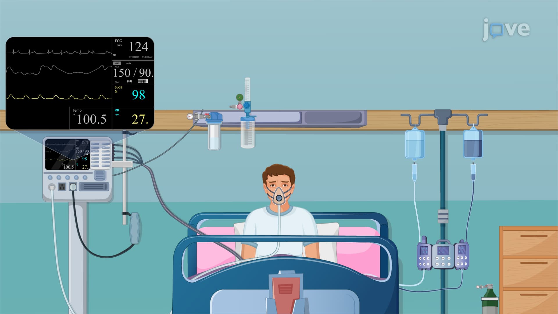 COPD: Management Using Bronchodilators and Corticosteroids