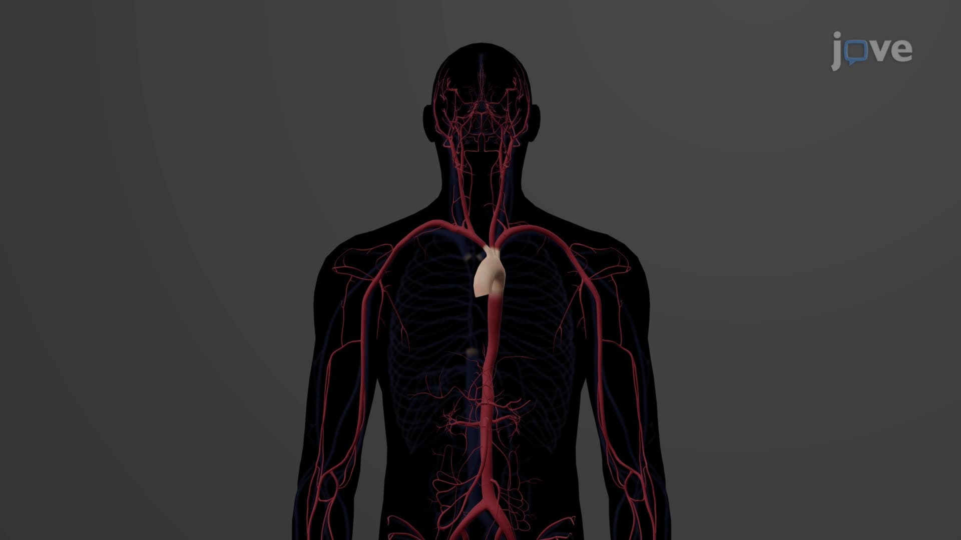 The Arch of Aorta