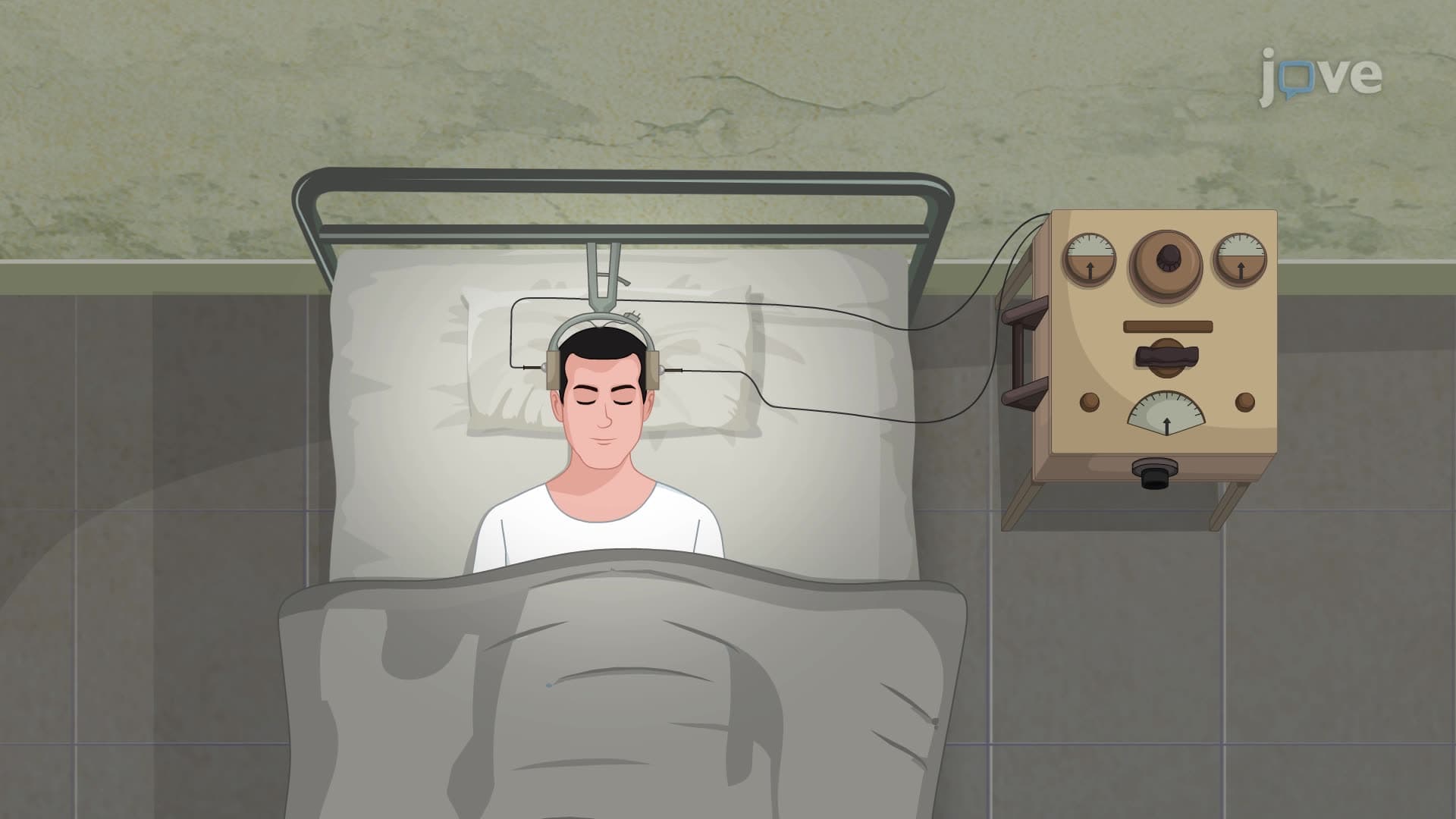 Electroconvulsive Therapy