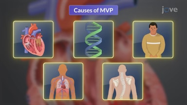 Valvular Heart Disease