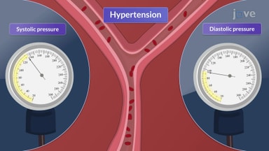 Disorders of the Vascular System