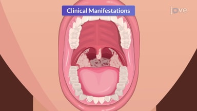 Upper Respiratory Tract Infections