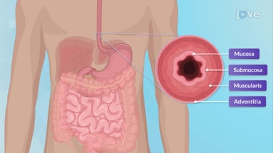 An Overview of the Gastrointestinal System: Anatomy, Physiology, and Assessment