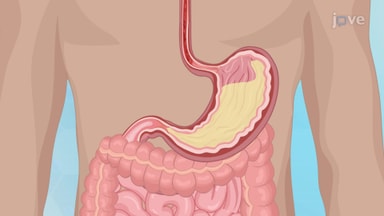 Disorders of the Esophagus