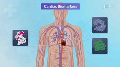 Cardiovascular Diagnostic Studies and Procedures